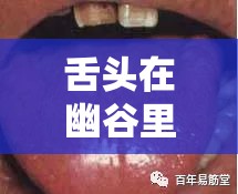 舌头在深谷里滑来滑去怎样回事