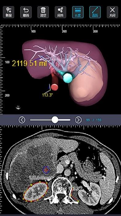 莲影最新版下载