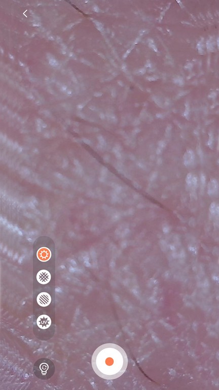 moreme皮肤检测仪app下载