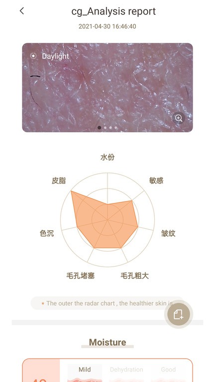 moreme皮肤检测仪app下载