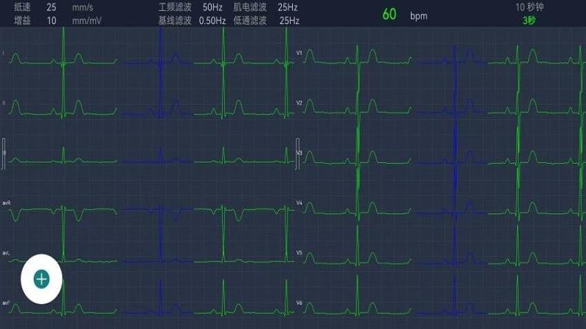 测心电商业版最新版
