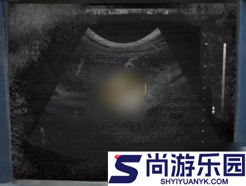 纸嫁衣8千子树第一章怎么过