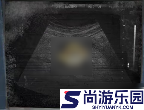 纸嫁衣8千子树第一章怎么过