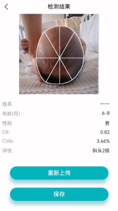StarBaby头形分析APP软件官方版