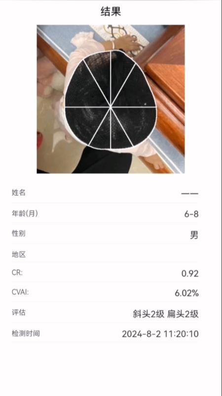 StarBaby头形分析APP软件官方版